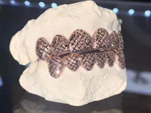 DIAMOND DUST (PER TOOTH)